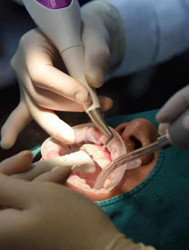 Dental care check up, Dentist examining and doing teeth treatment in dental clinic, Yearly visit for teeth cleaning and scaling to prevent gum disease problems, Healthy oral hygienic.