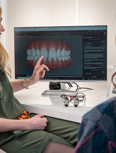 Invisalign for Overbite