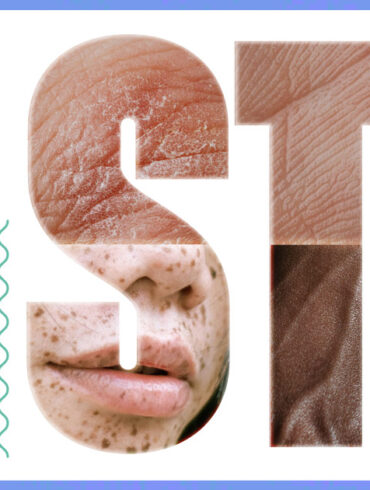 Risk of STI