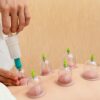 Meets Hijama