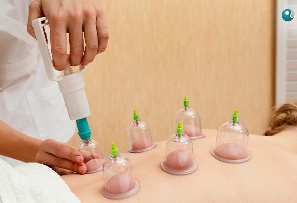 Meets Hijama