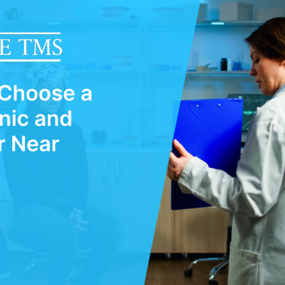 How to Choose a TMS Clinic and Provider Near You